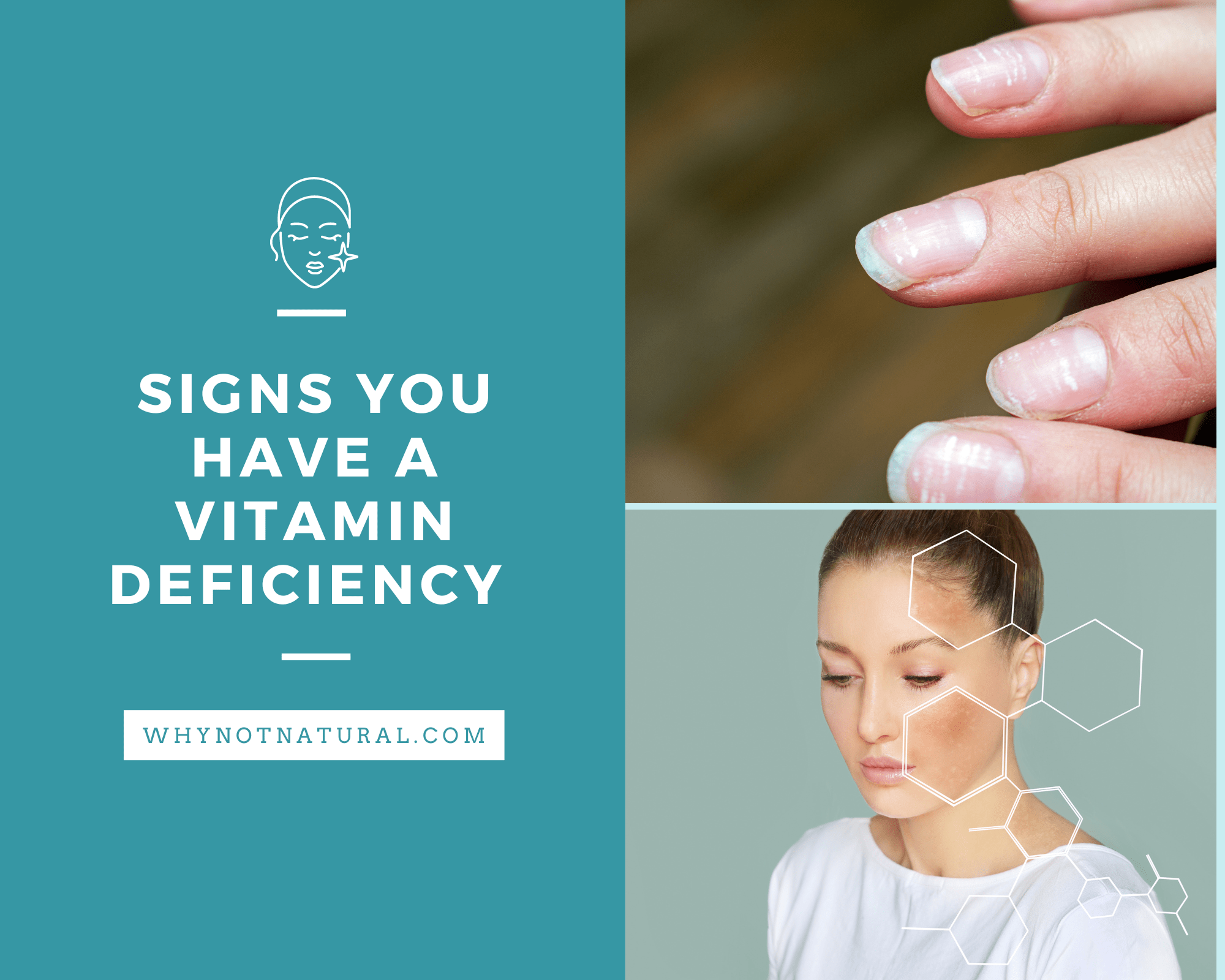 Signs That You Have A Vitamin Deficiency - WhyNotNatural